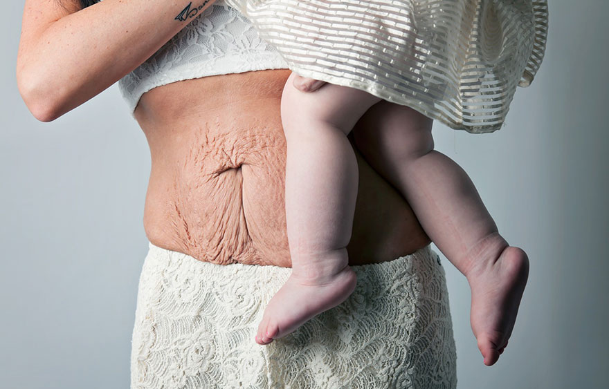 Esta íntima serie de fotos muestra la apariencia del cuerpo de las madres tras dar a luz