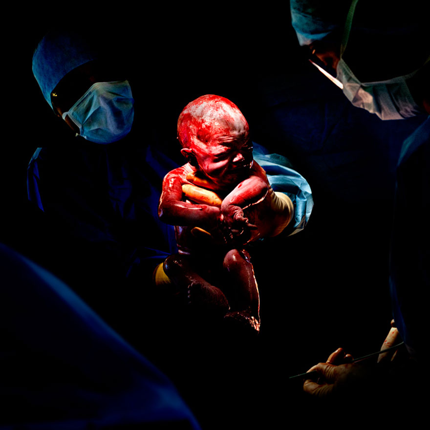 Estas fotografías de bebés fueron tomadas segundos después de su nacimiento