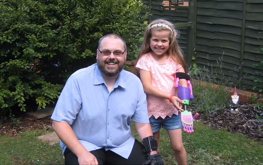 Esta niña recibió un brazo prostético impreso en 3D de un diseñador a quien también le falta un brazo