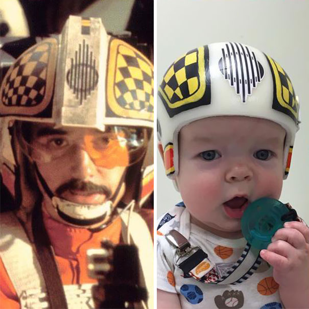 Este padre pintó con motivos de la Guerra de las Galaxias los cascos que tenía que llevar su hijo tras ser operado 