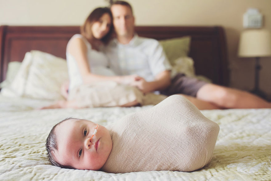Esta bebé tiene un tumor cerebral inoperable, así que sus padres hicieron una sesión de fotos para mostrar su amor