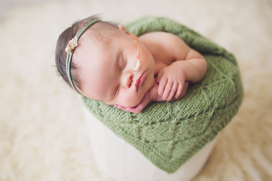 Esta bebé tiene un tumor cerebral inoperable, así que sus padres hicieron una sesión de fotos para mostrar su amor
