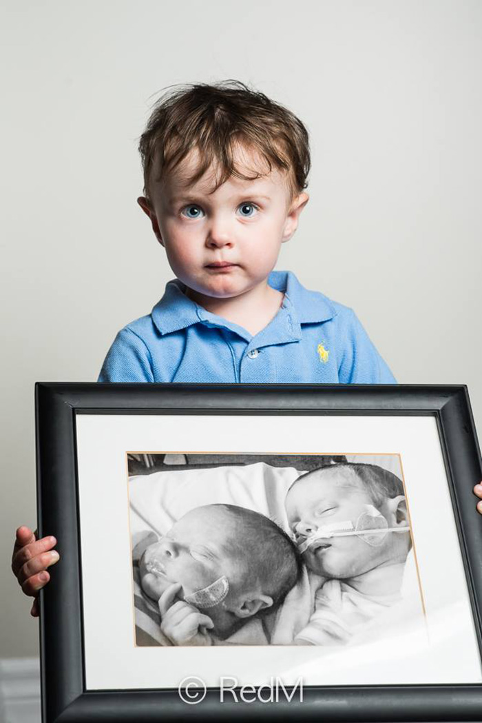 retratos-bebes-prematuros-les-premas-red-methot (12)