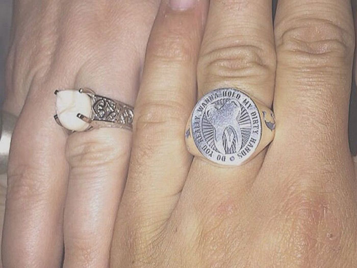 Esta mujer recibió un anillo de compromiso con una muela del juicio de su prometido
