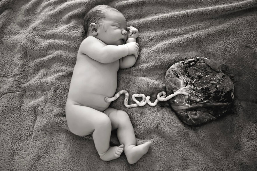 Esta madre celebra el nacimiento de su recién nacido con una foto del cordón umbilical formando la palabra "amor"