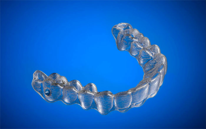 aparato-ortodoncia-impreso-3d-amos-dudley (3)