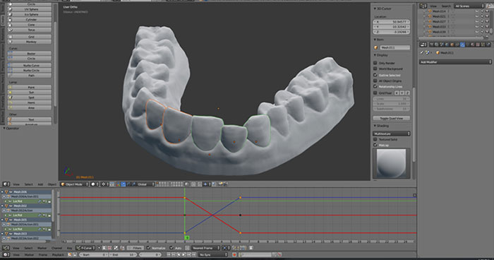 aparato-ortodoncia-impreso-3d-amos-dudley (5)