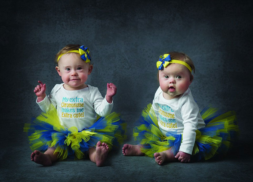 Estos bebés con síndrome de Down posan para una adorable sesión de fotos benéfica