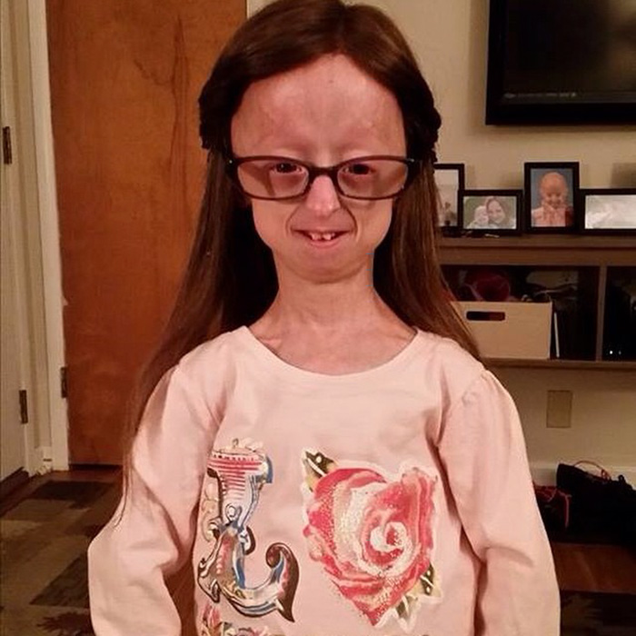 Esta niña de 12 años con una rara enfermedad se hizo amiga de un levantador de pesas llamado 'La Bestia'