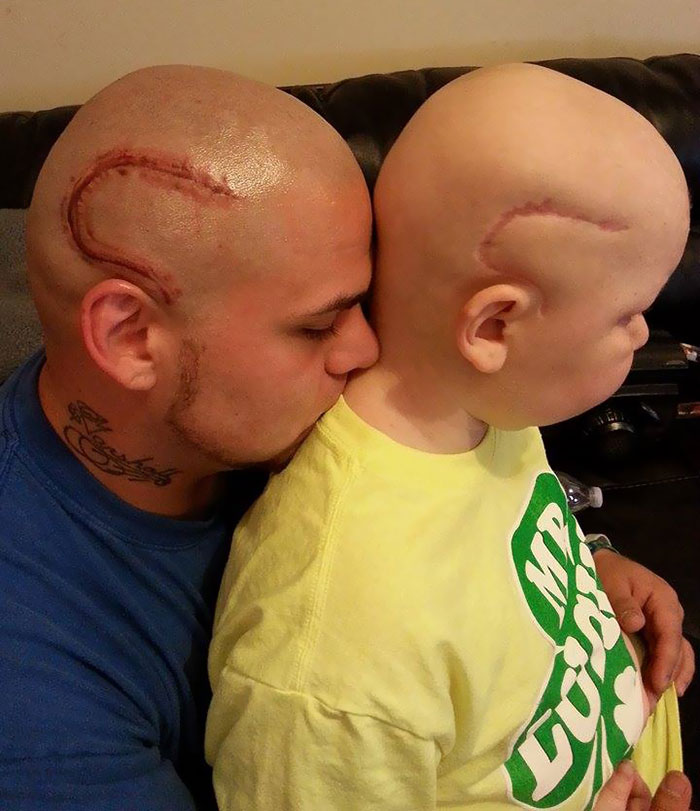 tatuaje-padre-cicatriz-cancer-hijo (1)