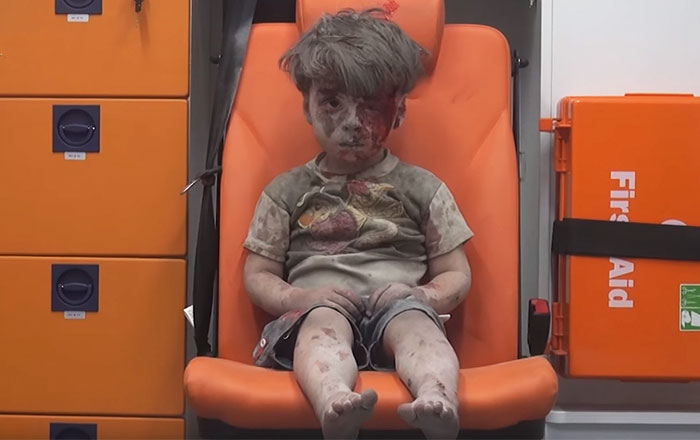 Esta desgarradora foto de un niño de 5 años totalmente aturdido muestra los horrores de la guerra civil siria
