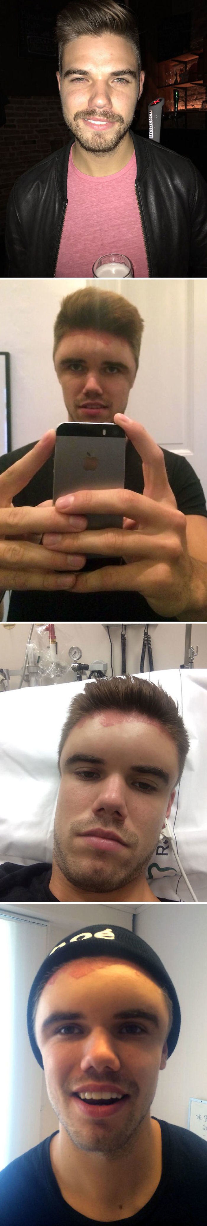 Mi Compañero De Clase Teñió Su Cabello Y Luego Se Dio Cuenta De Que Era Alérgico Al Tinte Para El Cabello