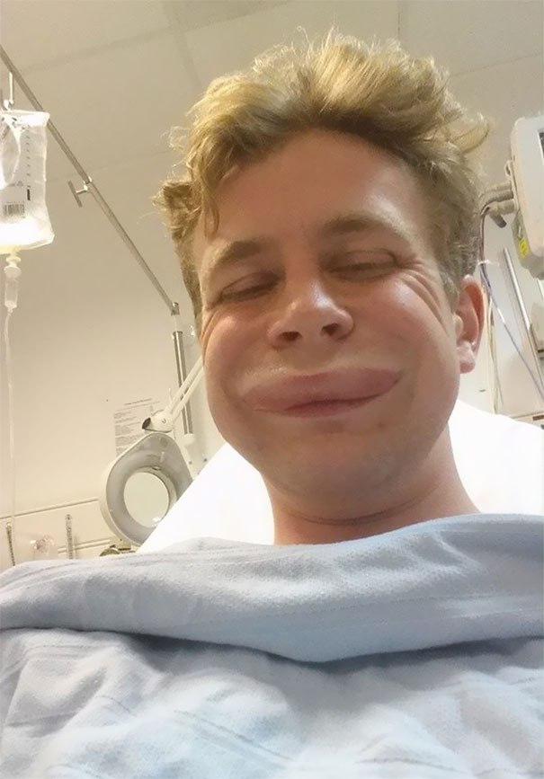 Selfie En El Hospital Tras Una Reacción Alérgica