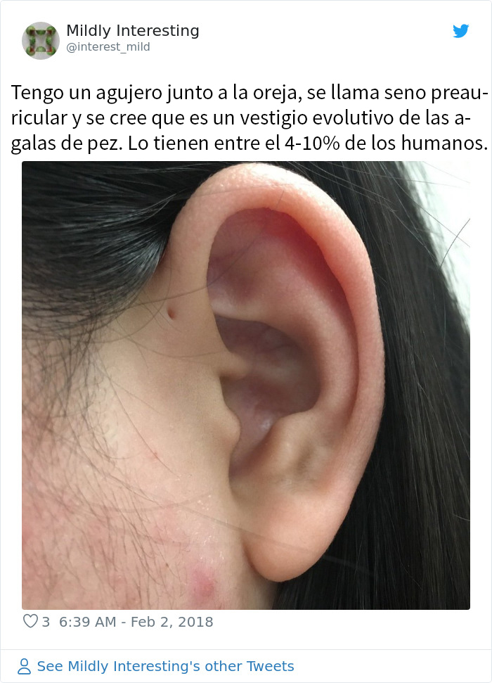 La gente se da cuenta de que estos agujeritos sobre sus orejas pueden tener una explicación evolutiva