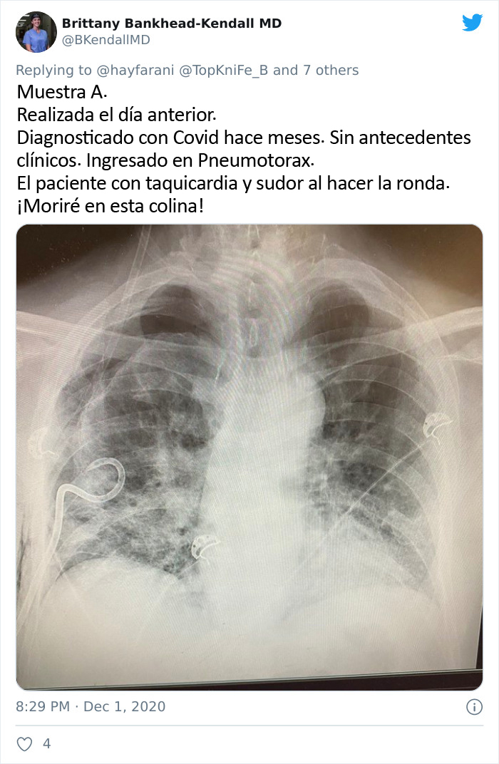 Unas radiografías muestran los efectos del COVID-19 en los pulmones comparados con los de un fumador