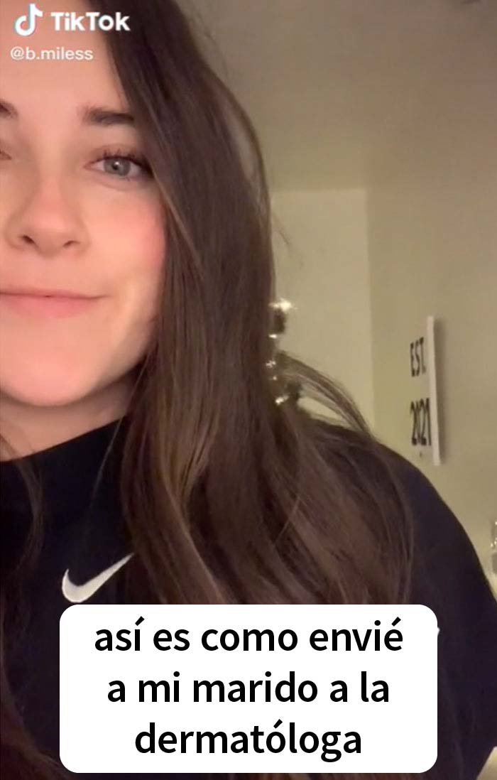 Esta esposa marcó los lunares de su marido antes de que fuera al médico y volvió con notas en su cuerpo Esta esposa marcó los lunares de su marido antes de que fuera al médico y volvió con notas en su cuerpo