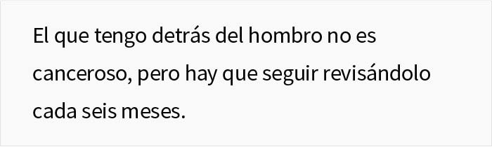Esta esposa marcó los lunares de su marido antes de que fuera al médico y volvió con notas en su cuerpo Esta esposa marcó los lunares de su marido antes de que fuera al médico y volvió con notas en su cuerpo