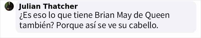 A este alegre ni&ntilde;o se le diagnostic&oacute; el s&iacute;ndrome del cabello impeinable