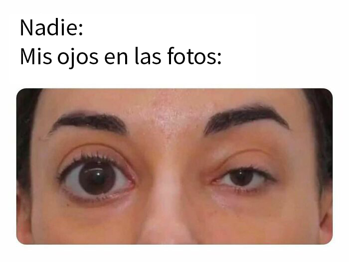 “Puberty Hits”: 40 Funny Pics That Hit Close To Home