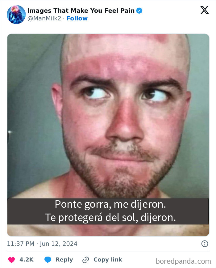 50 Painful Pics That Will Probably Make You Say “Okay, Enough Internet For Me For Today”