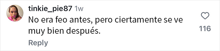 Se vuelven virales los resultados de la cirugía plástica de este paciente, que se ha quitado décadas de encima Se vuelven virales los resultados de la cirugía plástica de este paciente, que se ha quitado décadas de encima