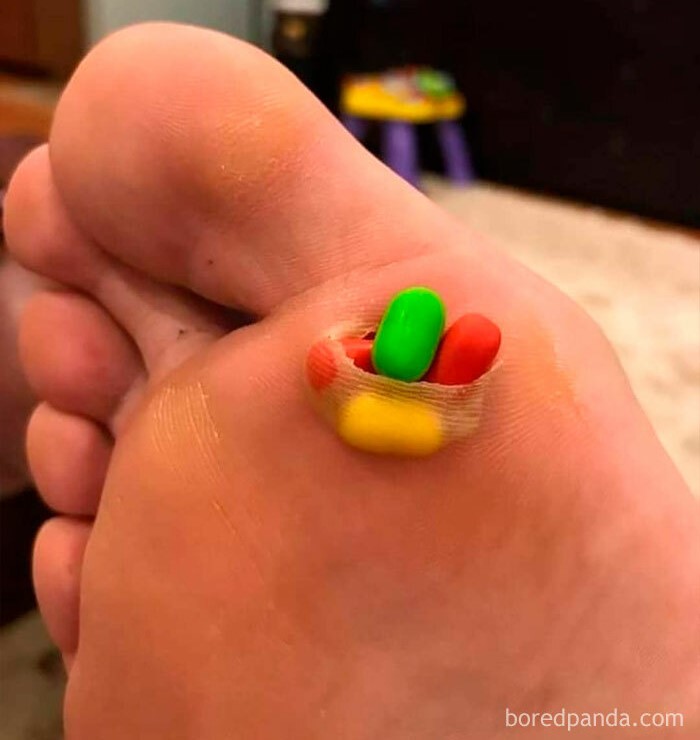 Pie con jalea en el dedo, causando incomodidad visual.