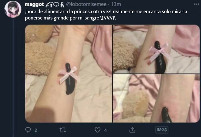 Brazo con venda negra y lazo rosa en foto de publicación que provoca vergüenza ajena.