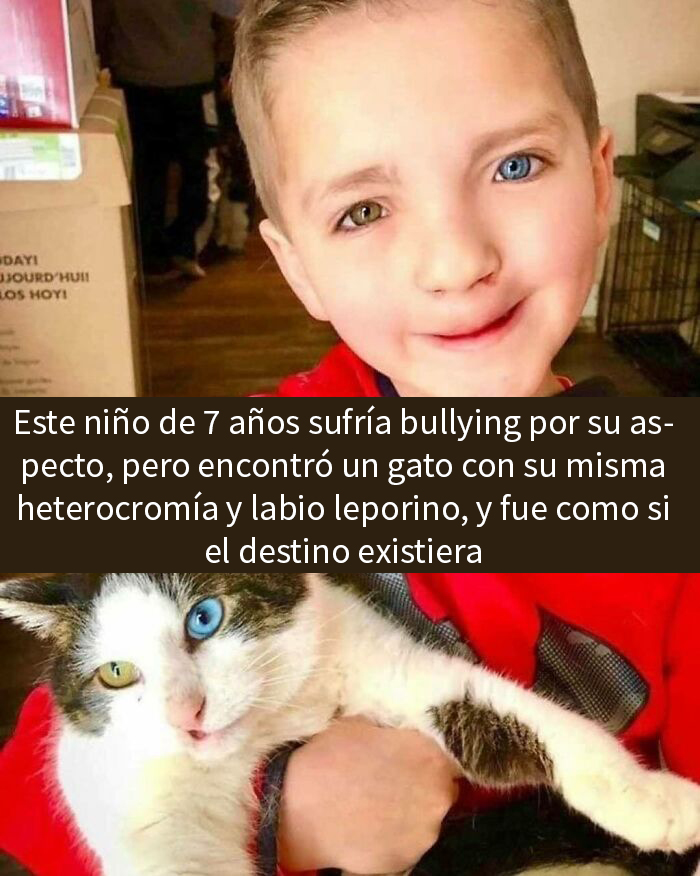 Niño con heterocromía sonríe junto a un gato especial en imagen adorable mostrando lo especiales que son los gatos.