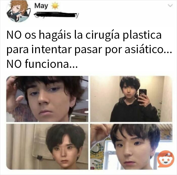 Montaje de fotos mostrando resultados de cirugía plástica fallida que provoca mucha vergüenza ajena en redes sociales.