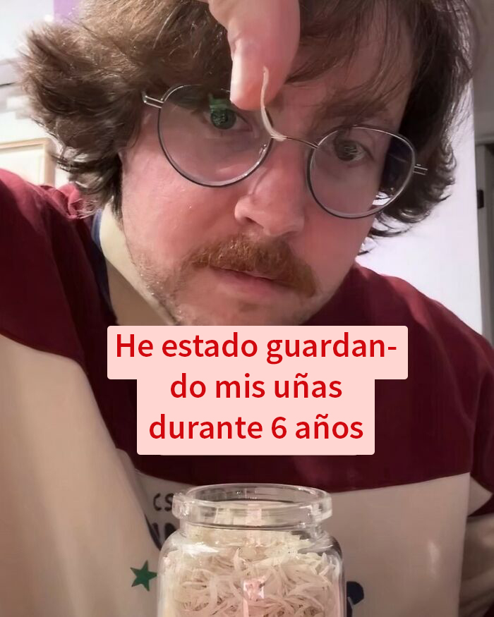 Hombre con gafas mostrando uñas guardadas en frasco, ejemplo de publicaciones que provocan vergüenza ajena.