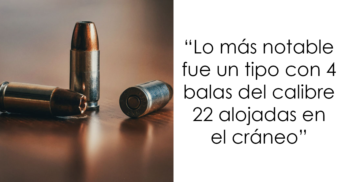20 Expertos en autopsias revelan sus hallazgos más extraños y singulares