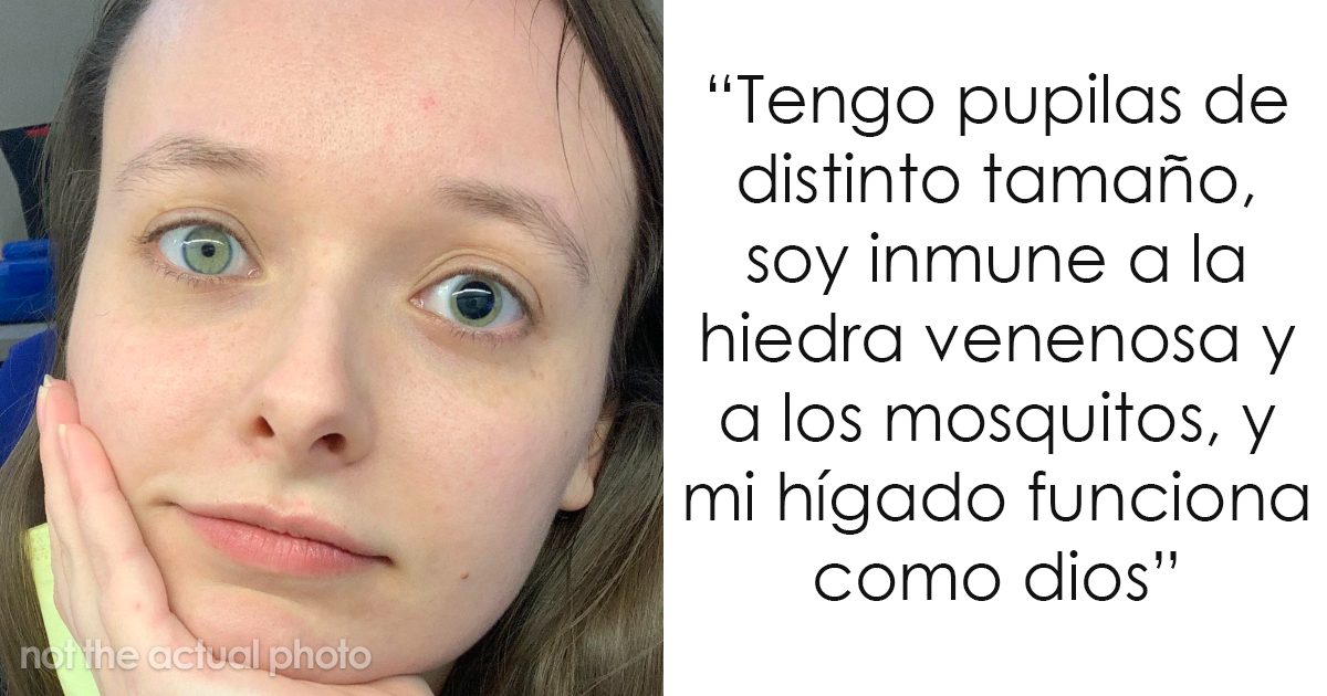 25 Personas que recibieron genes muy buenos o muy malos