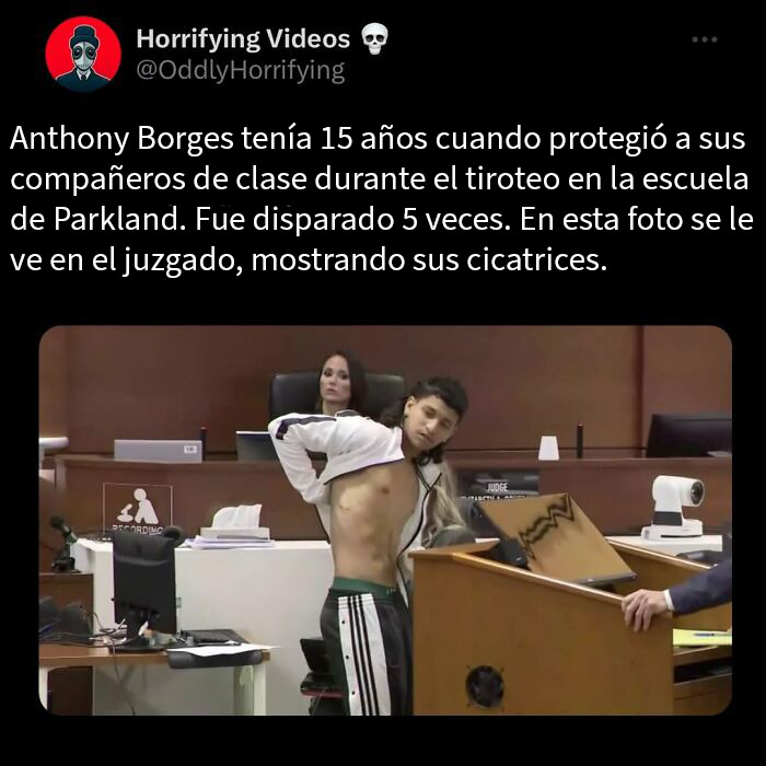 Joven mostrando cicatrices en corte tras incidente terrorífico, imagen relacionada con historias extrañamente terroríficas.