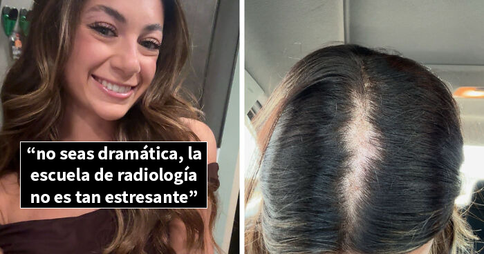 Estas personas comparten 20 fotos de antes y después de que la vida les pasara por encima
