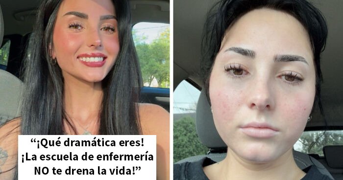 Estas personas comparten 20 fotos de antes y después de que la vida les pasara por encima