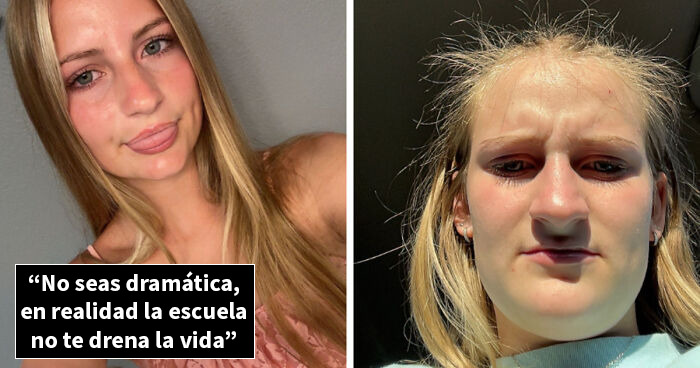 Estas personas comparten 20 fotos de antes y después de que la vida les pasara por encima