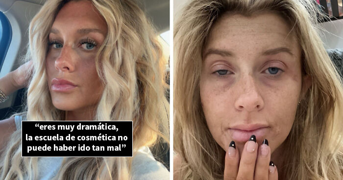 Estas personas comparten 20 fotos de antes y después de que la vida les pasara por encima