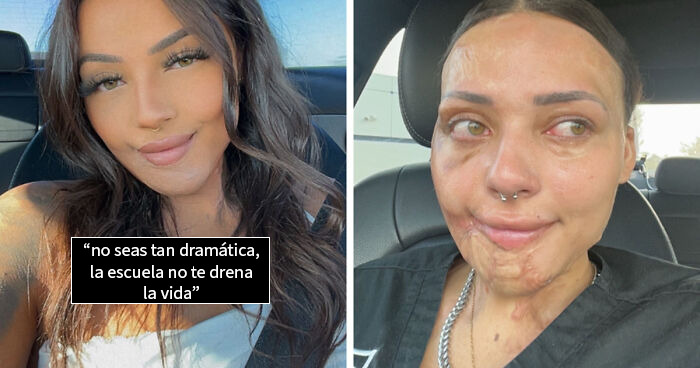 Estas personas comparten 20 fotos de antes y después de que la vida les pasara por encima