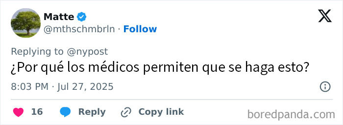 Mujer con los labios m&aacute;s grandes del mundo antes y despu&eacute;s de gastar 26000 d&oacute;lares en cirug&iacute;as extremas.