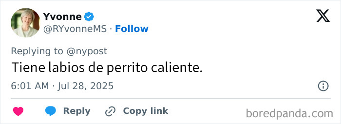 Tuit con comentario sobre mujer con los labios m&aacute;s grandes del mundo y sus cirug&iacute;as extremas por 26000 d&oacute;lares.