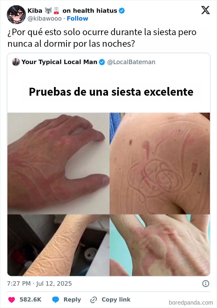 Manos y brazo con marcas tras siesta, meme divertido que refleja humor sobre todo y nada para hacerte reír.