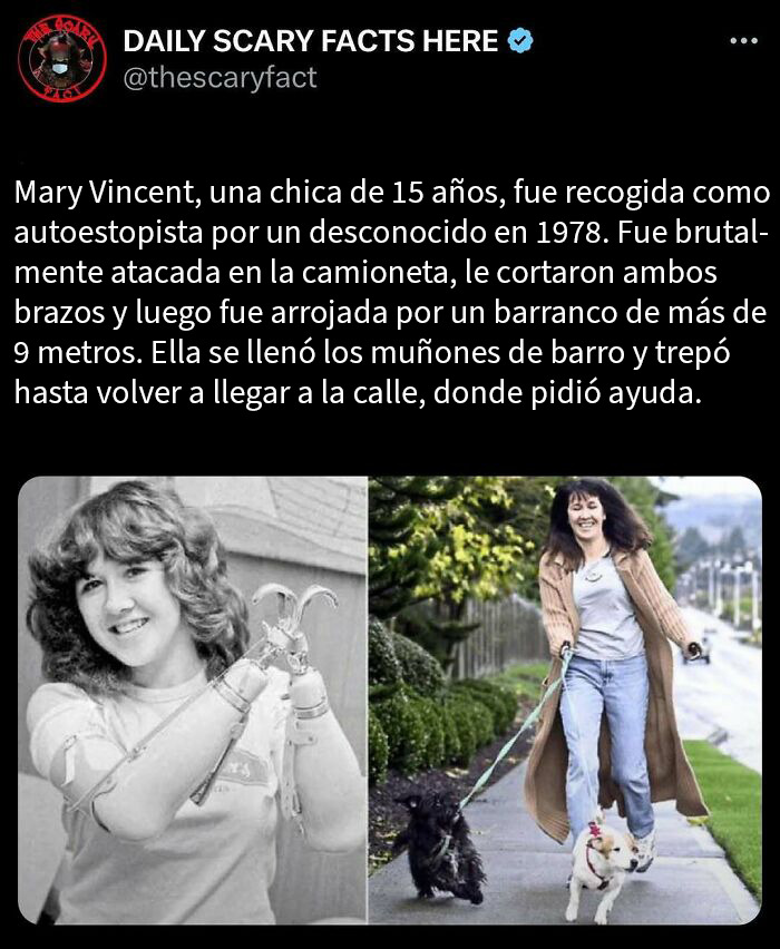 Mujer con prótesis en brazos y paseando perros, ilustrando datos terroríficos impactantes para no leer a oscuras.