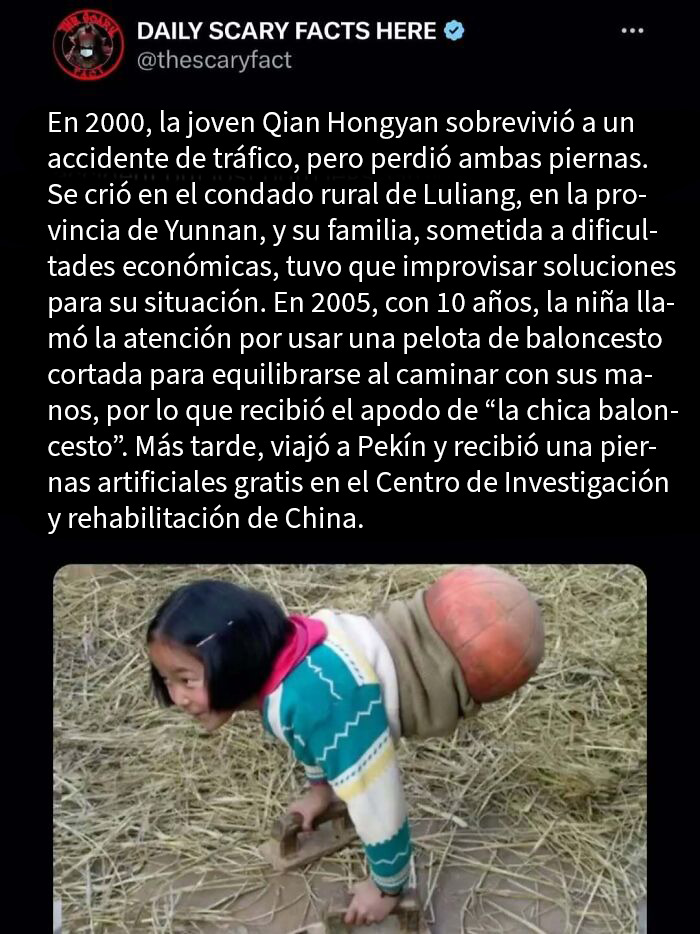 Niña sin piernas usando una pelota de baloncesto para caminar, un dato terrorífico que no deberías leer a oscuras.