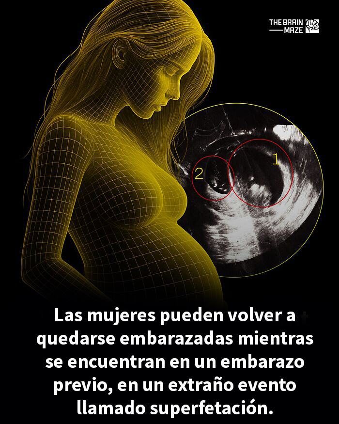 Mujer embarazada con ilustración y ultrasonido mostrando superfetación rara, datos interesantes del cuerpo y mente.