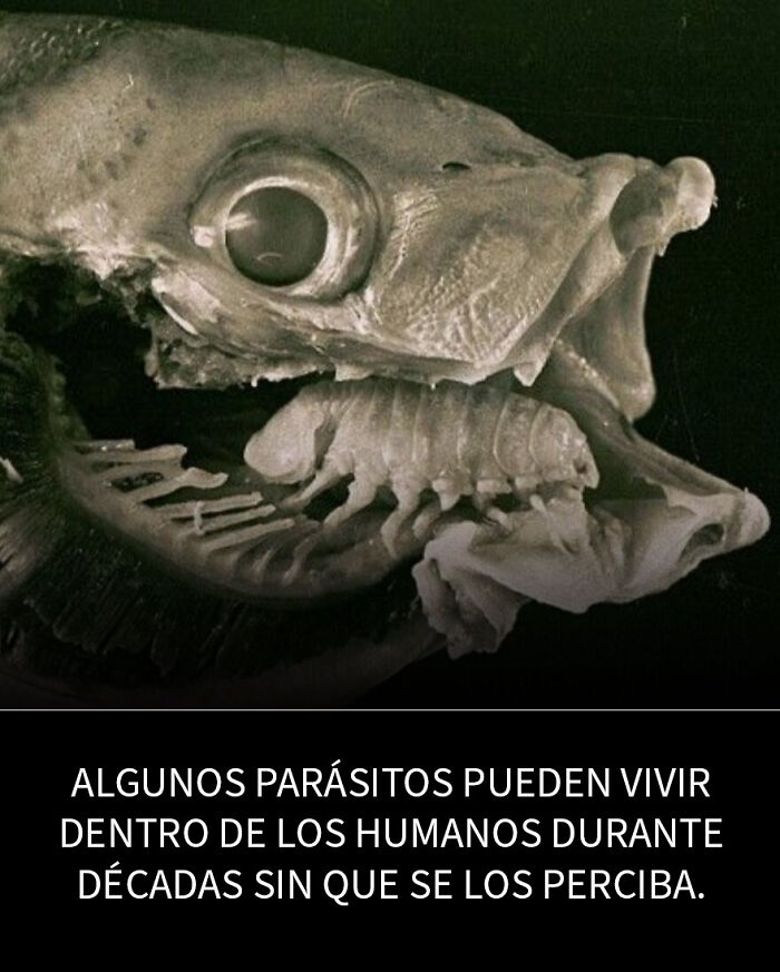 Imagen en blanco y negro de una resonancia cerebral que muestra un quiste grande con contenido inquietante y datos perturbadores.