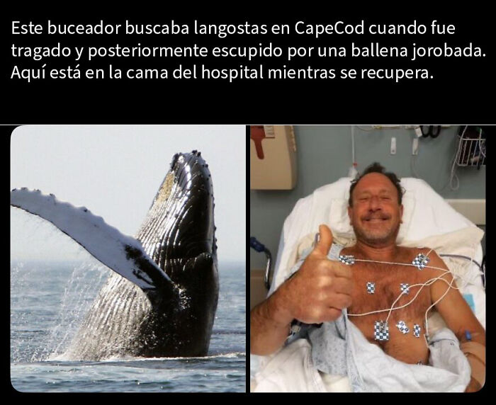 Buzo tragado y escupido por ballena jorobada, levantando pulgar en cama de hospital, hecho inquietante y creepy.