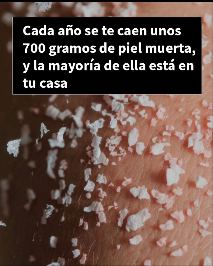 Mujer con collarín y vendaje tras visita al quiropráctico, mostrando hechos inquietantes y datos perturbadores.