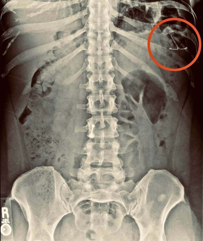 “All The Adults Just Gasped”: 56 Times One Tiny Detail Changed The Entire Story