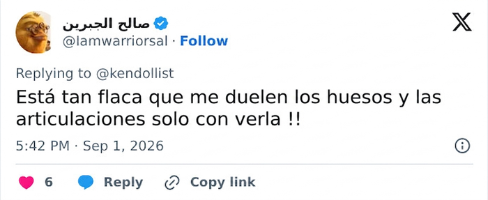 Las fotos en bikini de Kendall Jenner desatan confusión sobre su zona íntima: "Perdón, pero ¿cómo puede tenerlo tan pequeño?" Las fotos en bikini de Kendall Jenner desatan confusión sobre su zona íntima: "Perdón, pero ¿cómo puede tenerlo tan pequeño?"