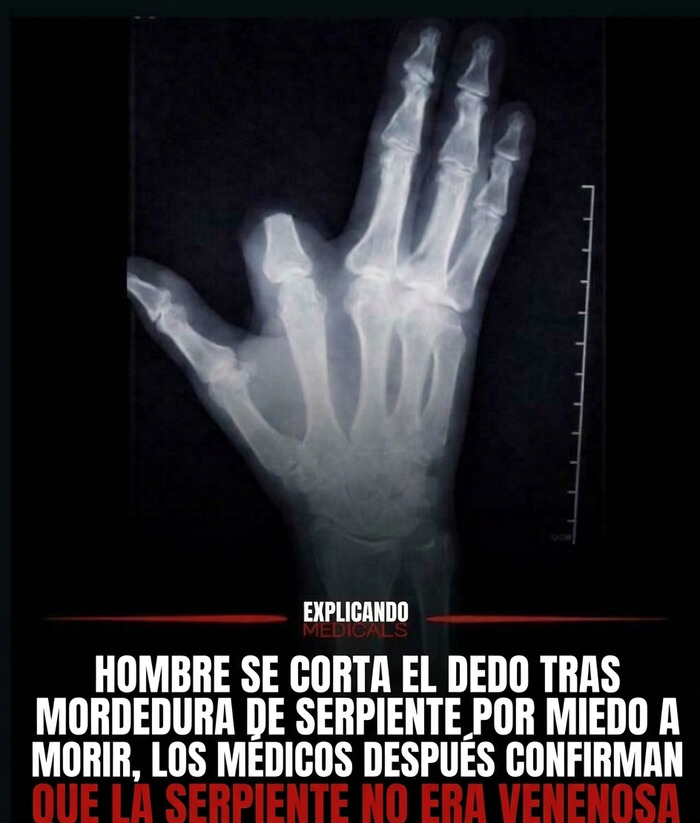 Lo que pasa por dejarse llevar por el pánico